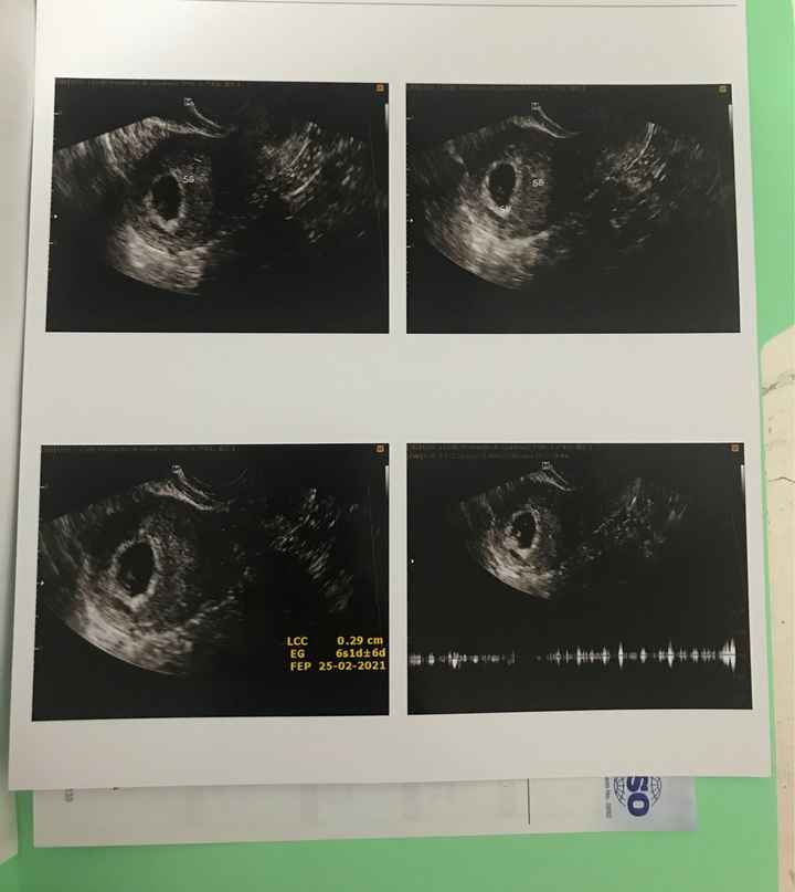 Vamos a ser papás!!! 🥰🤰🏻 - 2