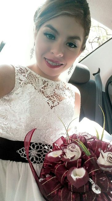 ¡a 36 dias  de la boda y me quitan mis brackets! - 1