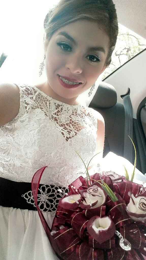 ¡a 36 dias  de la boda y me quitan mis brackets! - 1