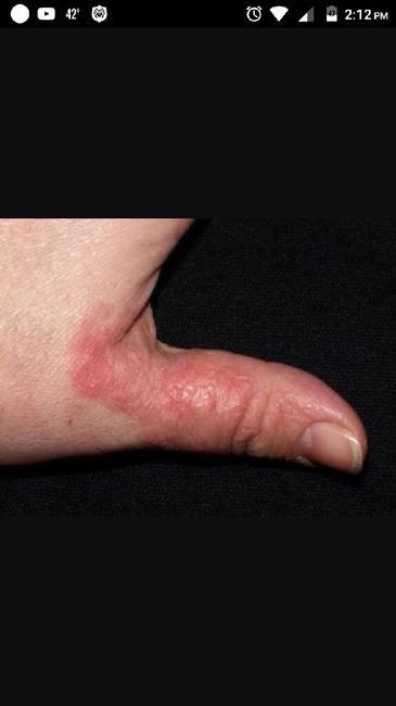 Los nervios y sus efectos - 2