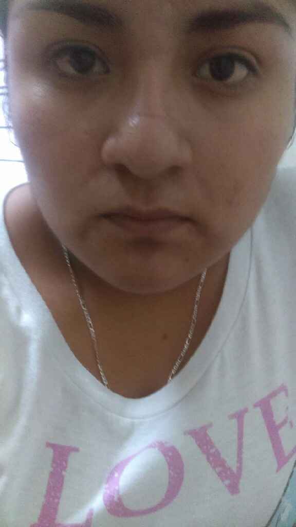 Manchas en la cara! - 1