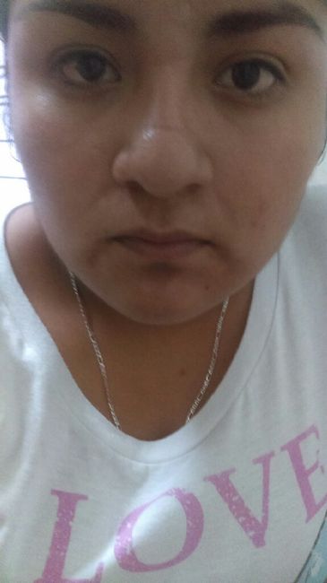 Manchas en la cara! - 1