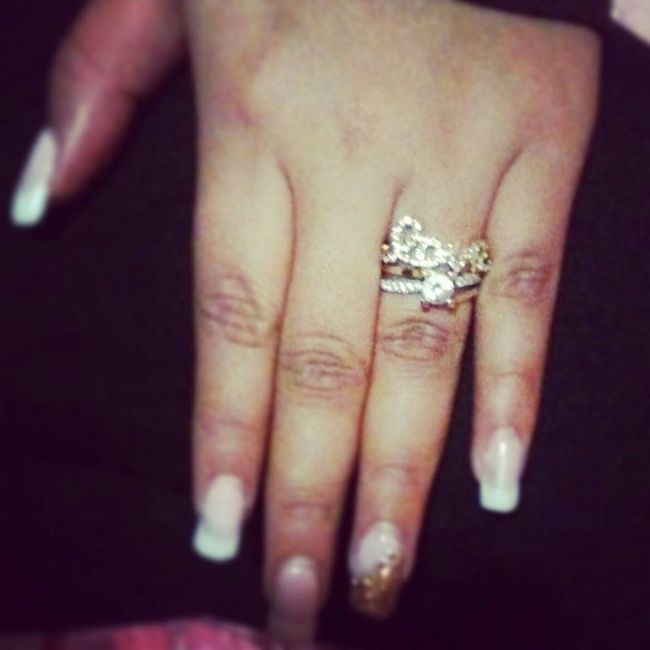 anillo