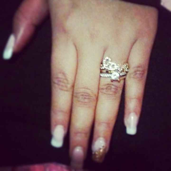 anillo