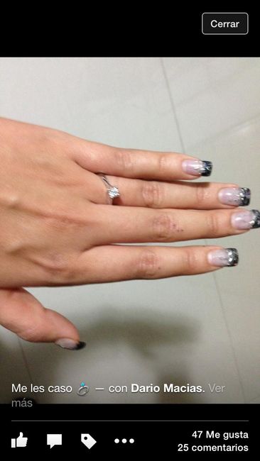 Anillo 