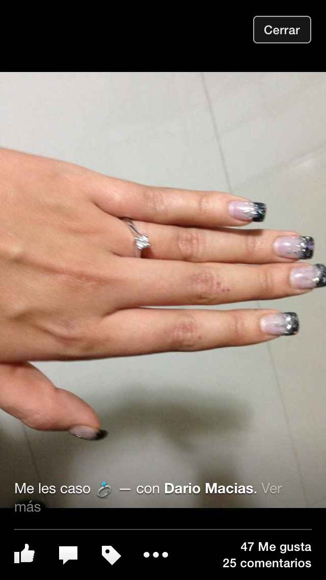 Anillo 