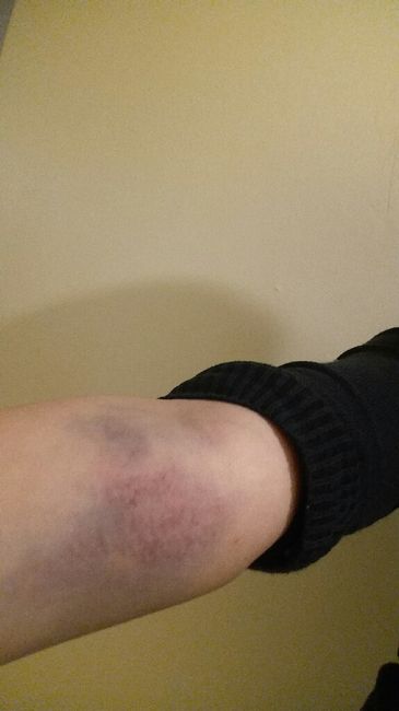 a 17 días y exámenes prenupciales - 1