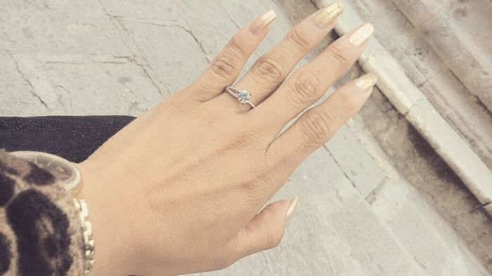 anillo 