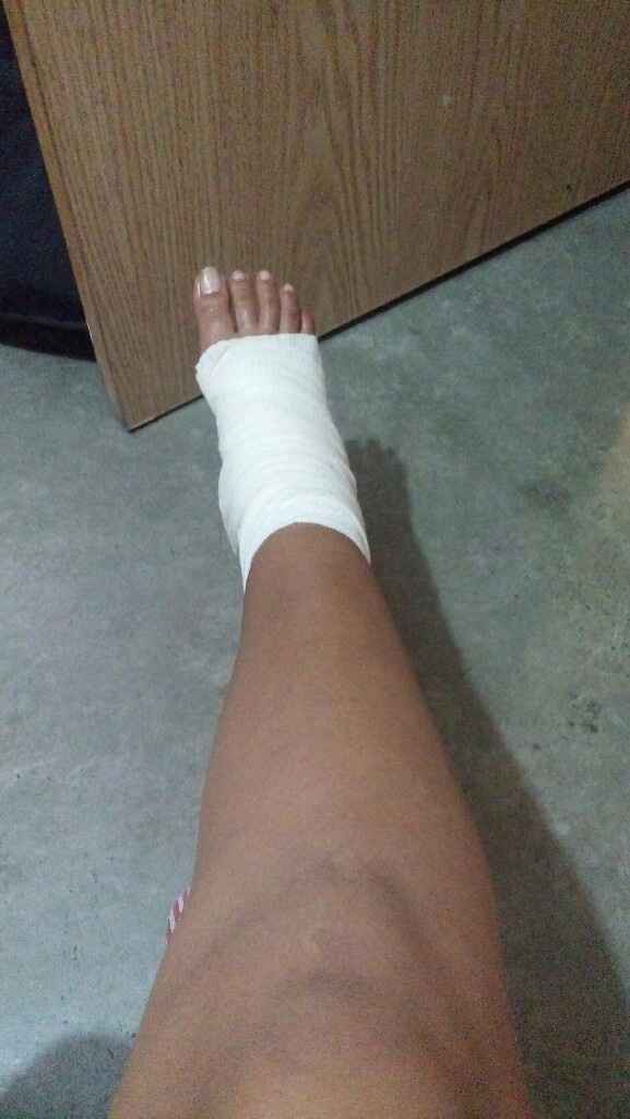  Mi accidente de último momento😓😂 - 1