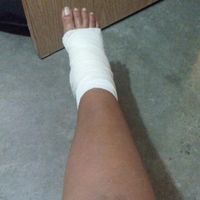  Mi accidente de último momento😓😂 - 1