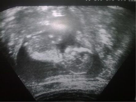 Mamá preocupada - 1