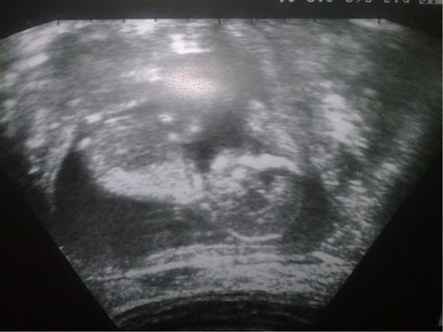 Mamá preocupada - 1