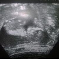 Mamá preocupada - 1