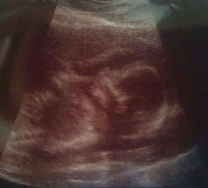 ¿quien ya tiene bebes?? presumanlos - 1