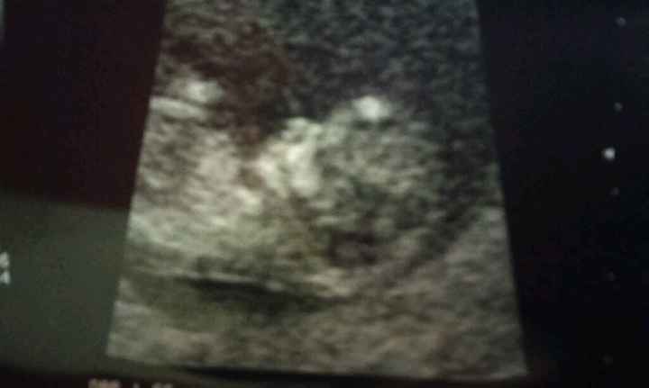 Les presento a mi bb - 1