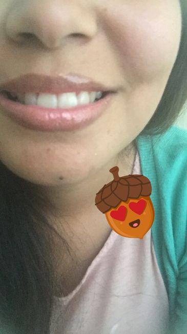  Adiós brackets!!! - 1