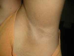 Help me :( axilas obscuras - 3