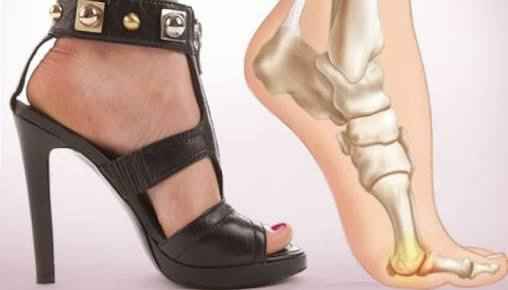 Consejos para usar zapatos altos!!! - 4