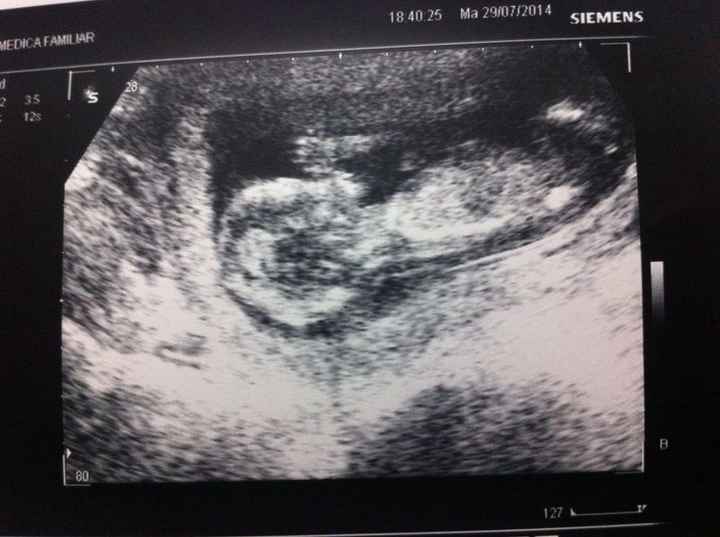 Muriendo de la emoción!!! - 1