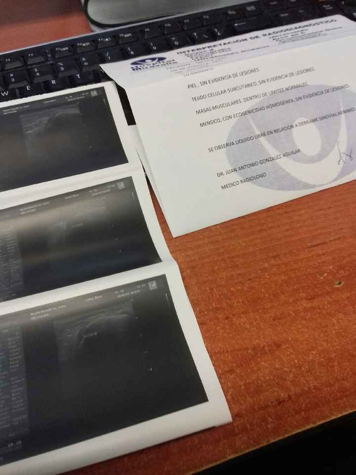 A 13 dias y supeeer tristeeeee😢😢😢😢 - 1