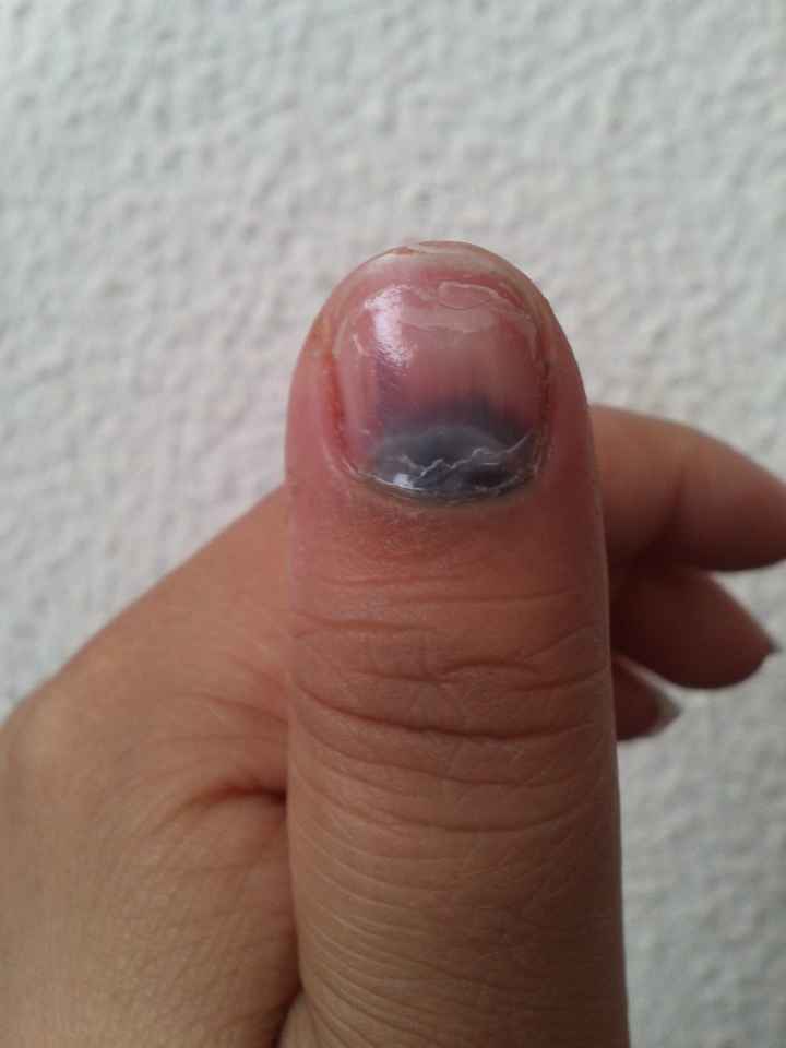 mi primer accidente de casada