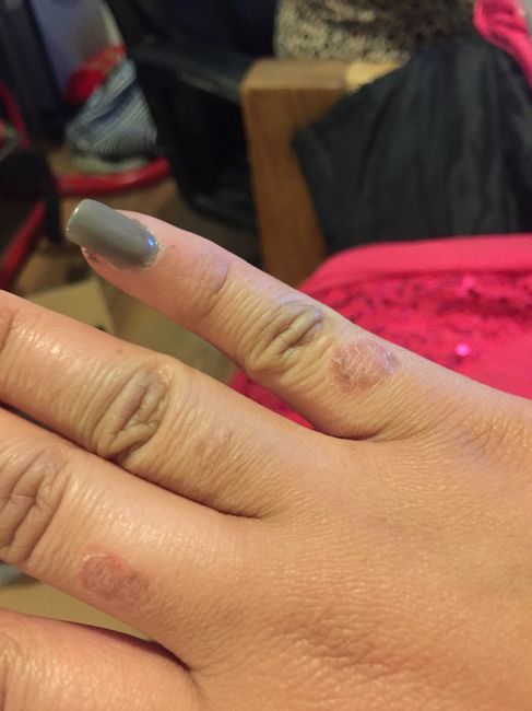 A 99 días esto llevó! - 18