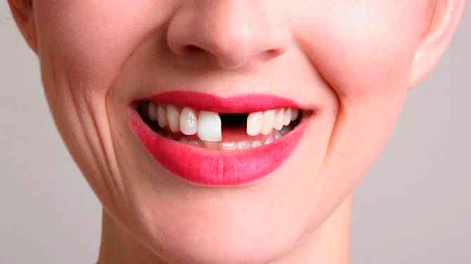 ¡Soy tan feliz por no ir con mi ventanita!