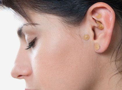 Auriculoterapia