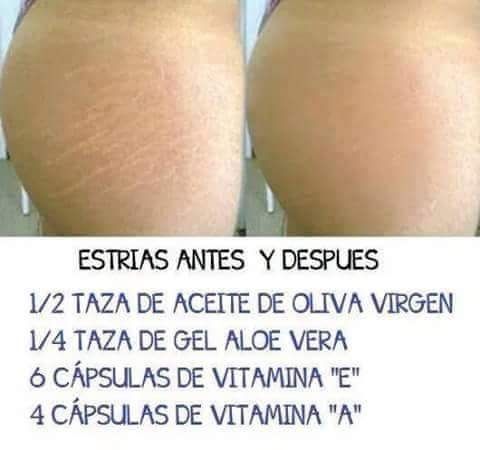 Crema anti estriass???? - 1