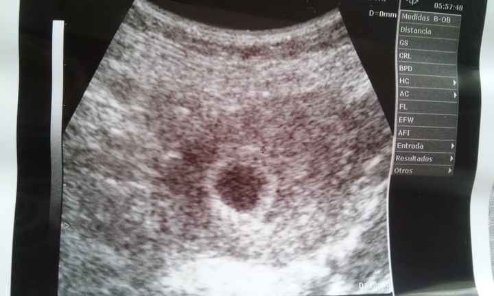 Sorpresa frustrada... :( - 1