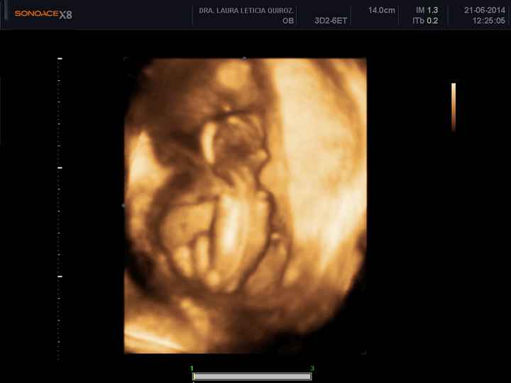 mi bebe