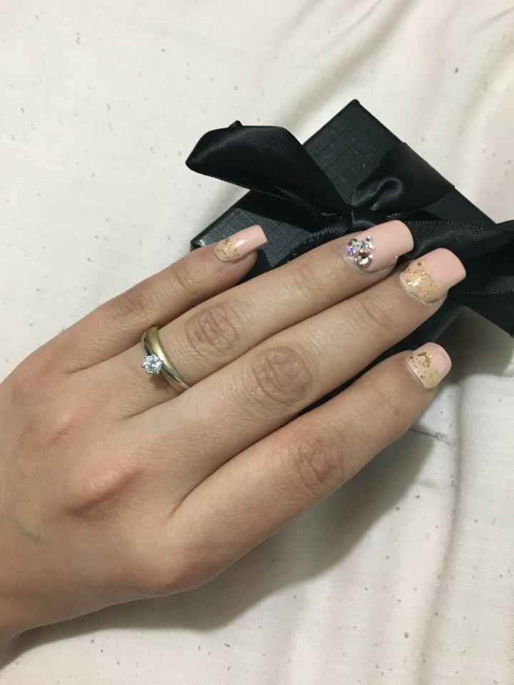 anillo