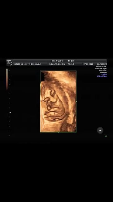 Cómo saber si ya es hora de tener hijos - 1