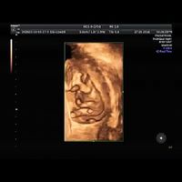 Cómo saber si ya es hora de tener hijos - 1