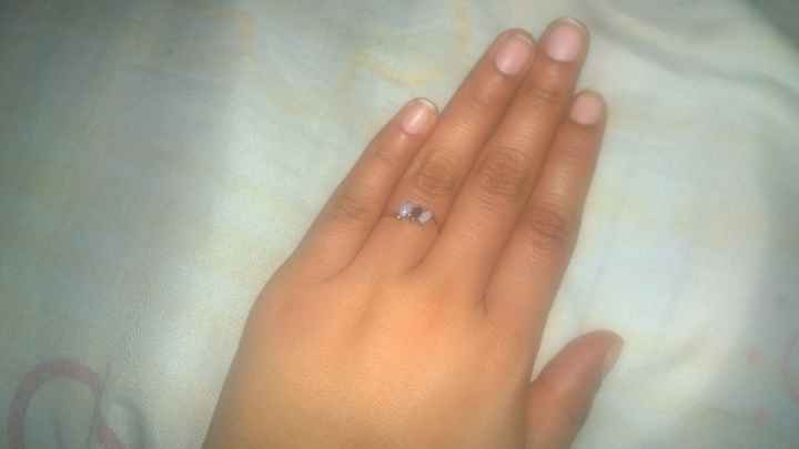 anillo 