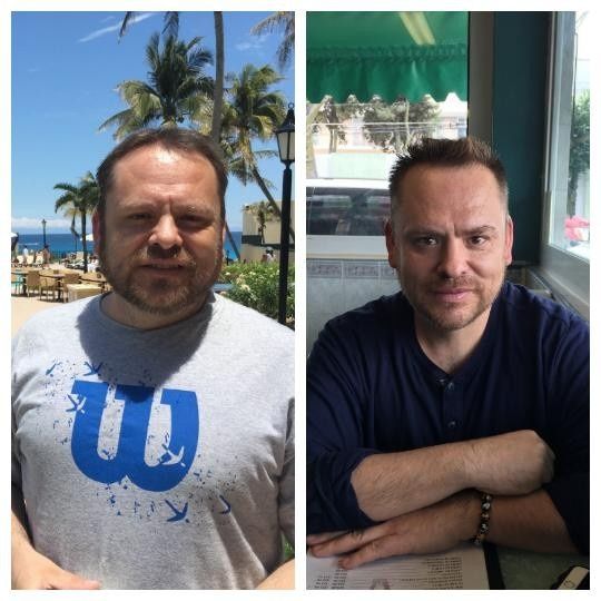 hermano, dia 1 al dia 40 (final de su tratamiento)