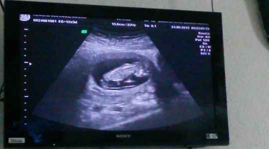 Nuestro cachorro!!... jijijiji - 5