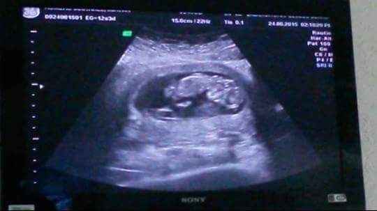 Mamis embarazadas!! - 3