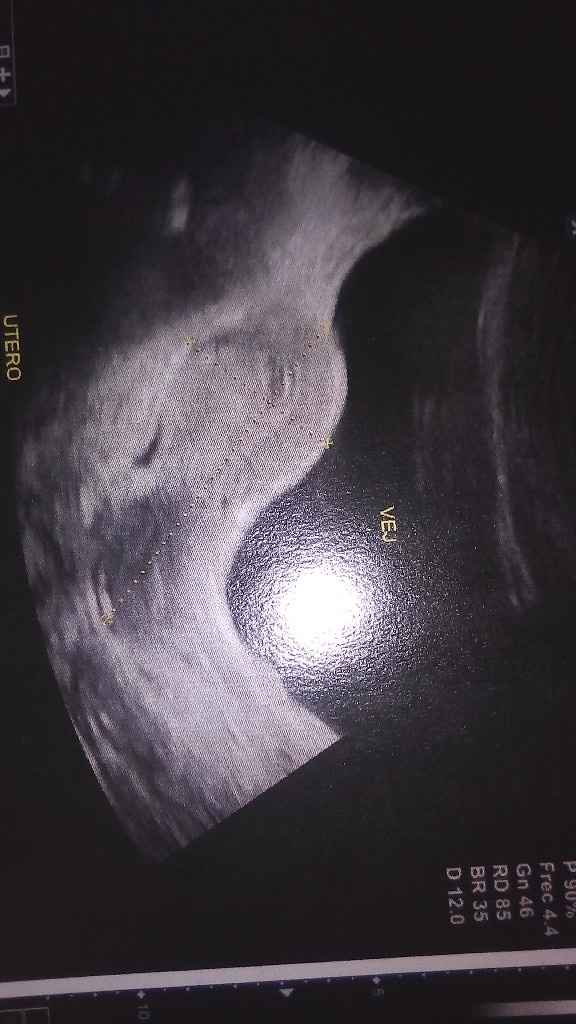 Debastada y feliz... Confundida !!! ❤️😭☺️ - 1