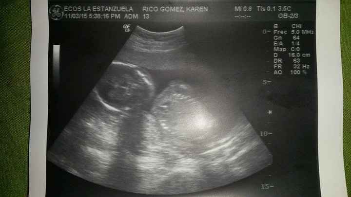 mi pequeño angelito 18 semanas