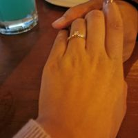 ¿De qué forma es la piedra? - 1