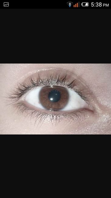 Ojos - 5