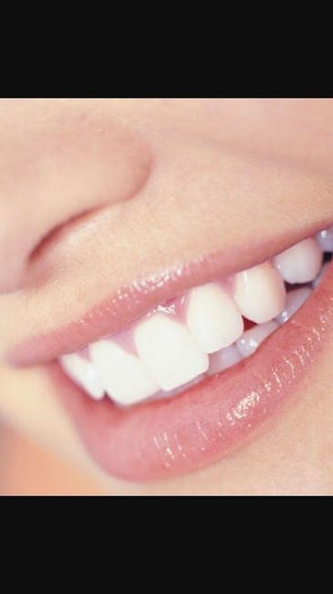 Cosas q podrían estropear tu sonrisa el dia b - 12