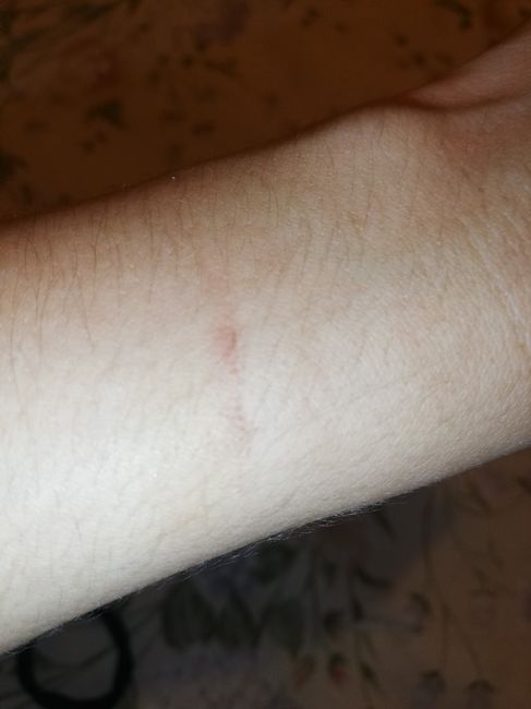 Lo que me enseñó el llevar marcas de violencia 3