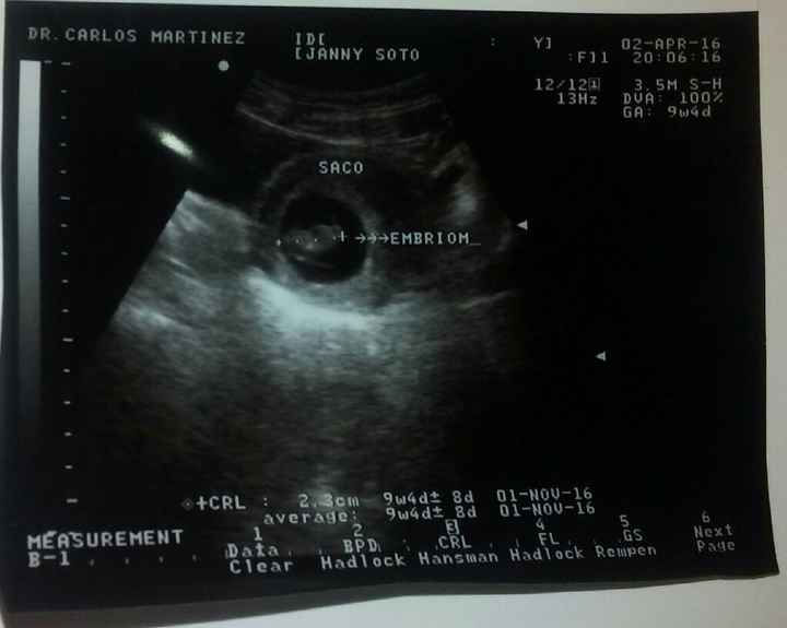 Una gran bendicion a llegado a mi vida - 1