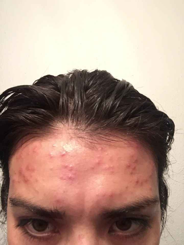No te recomiendo la depilación facial - 1