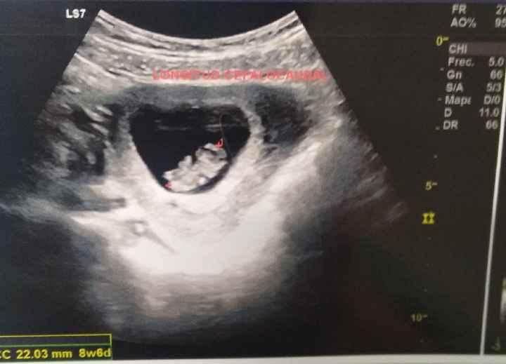 ¿Ansiosa para ser mamá? - 3
