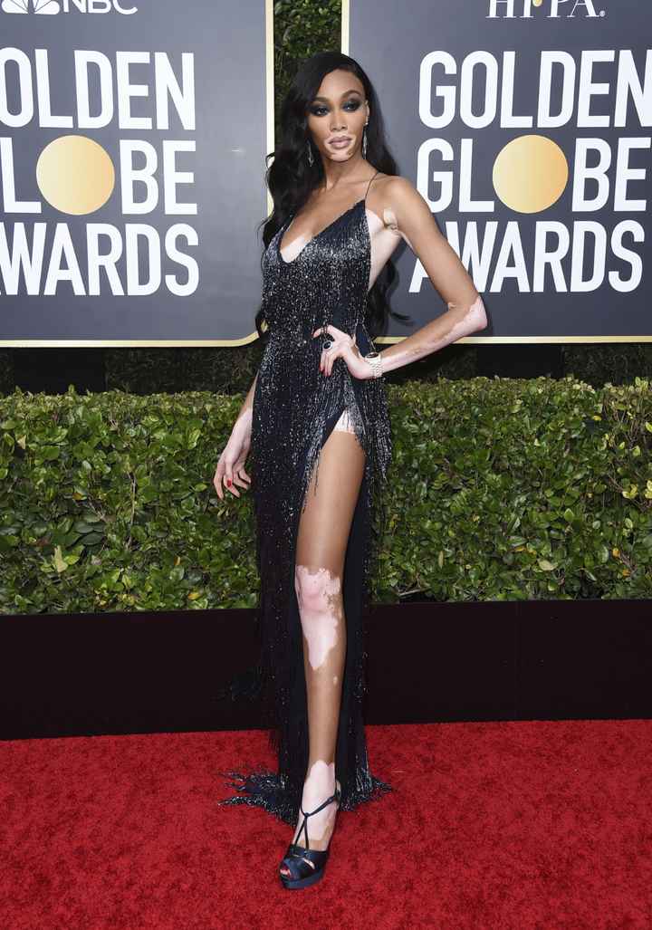 10) Winnie Harlow (¡guapa!)