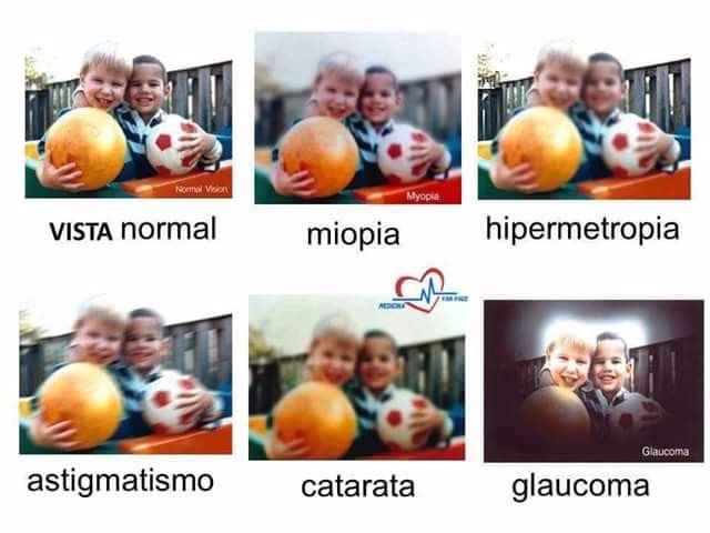 Imaginen, yo tengo miopia y astigmatismo