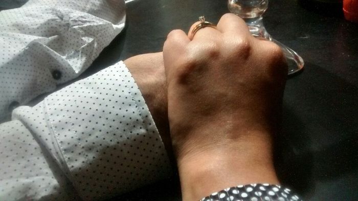 ¿Cómo es tu anillo de compromiso? - 2